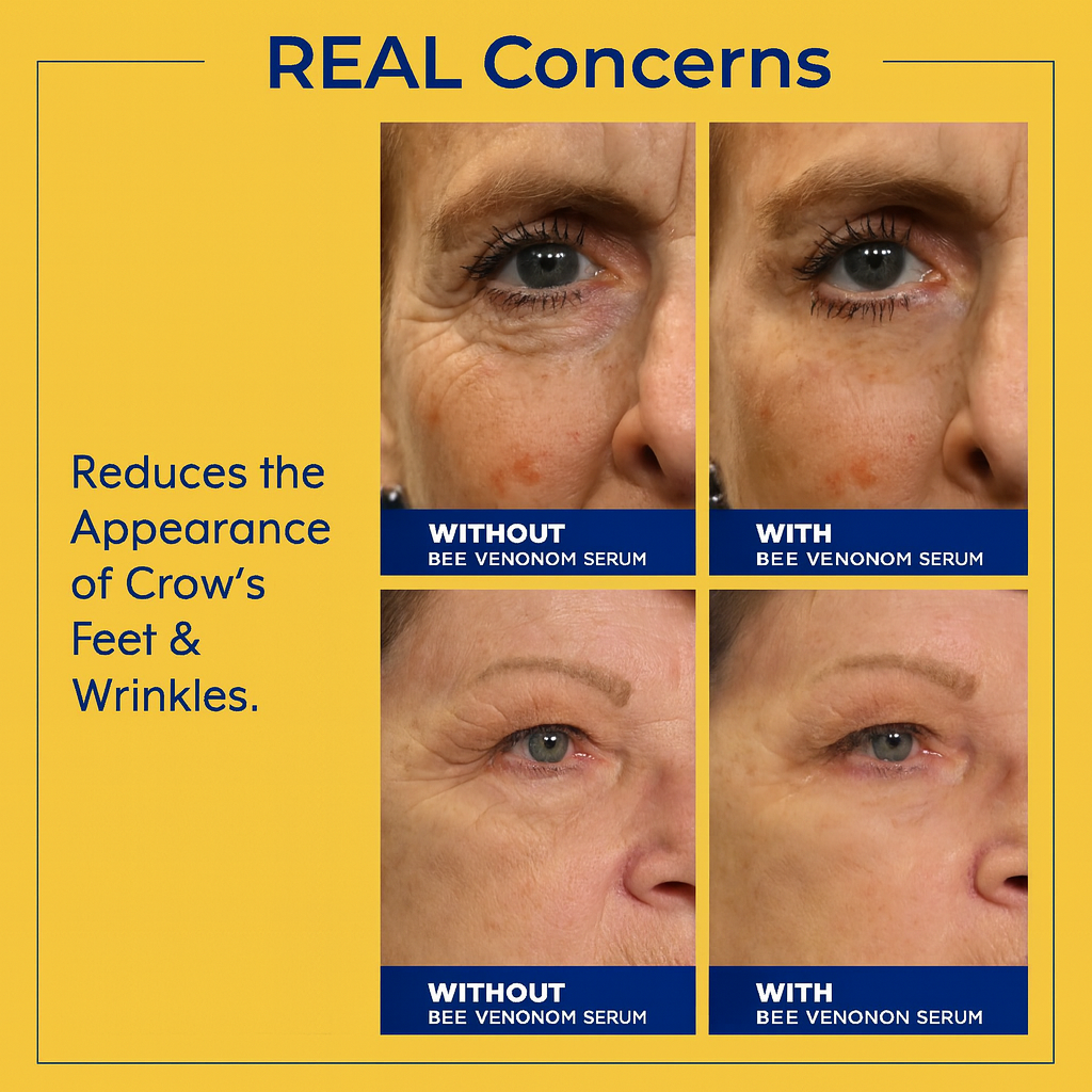 Fiyora Bee Venom Cream – Your 10-Minute Wrinkle Fix
