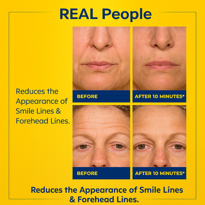 Fiyora Bee Venom Cream – Your 10-Minute Wrinkle Fix